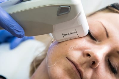 Safe and Effective Skin Lift with Expert HIFU Treatment Dubai