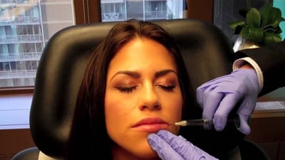 Does a Lip Flip Naturally Minimize Gum Show When Talking?