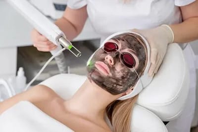 How Laser Carbon Peel Promotes a Refined and Polished Look?