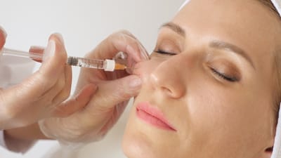 How Do Cheek Fillers Add Volume to Lift Facial Features?