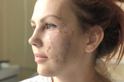 Does Best Scar Removal Promote Firmer Looking Skin?