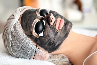 Does Laser Carbon Peel Reduce Brown Spots?