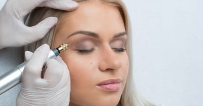 Does Plasma Pen Treatment Encourage Tissue Remodeling?