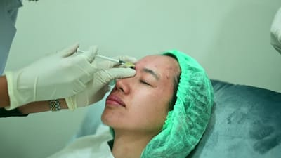 Does Full Face Botox in Dubai Reduce Forehead Lines?