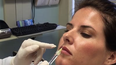 Is Lip Filler the Best Solution for Naturally Thin Lips?