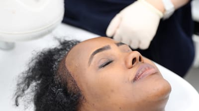 How Safe Is Hair Transplant For Different Age Groups Now?