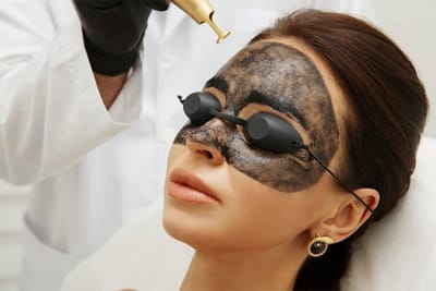 How Does Laser Carbon Peel Enhance Natural Skin Brightness?