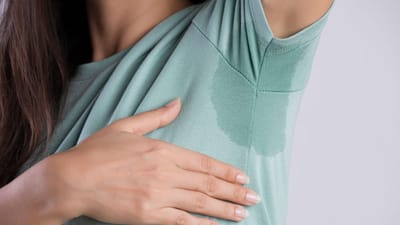 Is Hyperhidrosis Treatment the Answer to Constant Sweating Woes?
