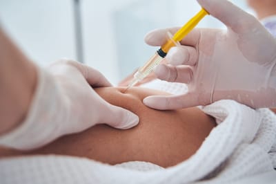 Can Fat Dissolving Injections Improve Overall Body Shape?