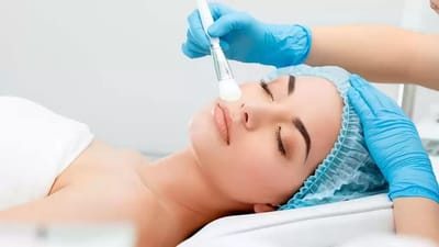 How Long Do Chemical Peels for Acne Scars Take to Work?
