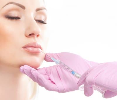 How Do Lip Fillers Define the Cupid’s Bow Area?