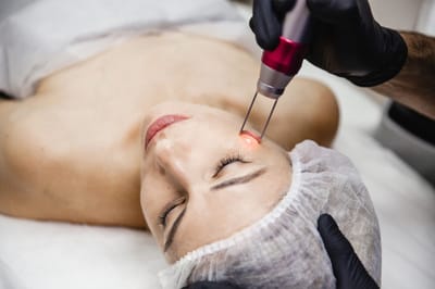 Can Fractional CO2 Laser Treatment Be Done on All Skin Types?