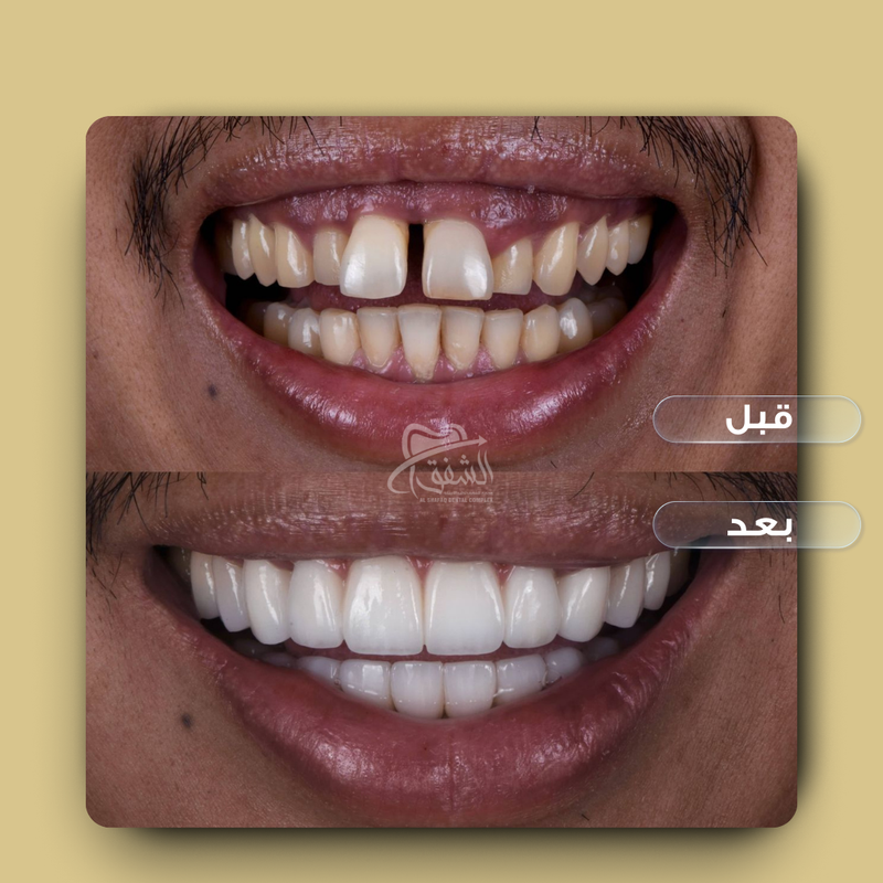 تقويم وتركيبات