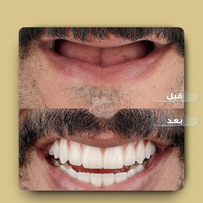 تقويم وتركيبات