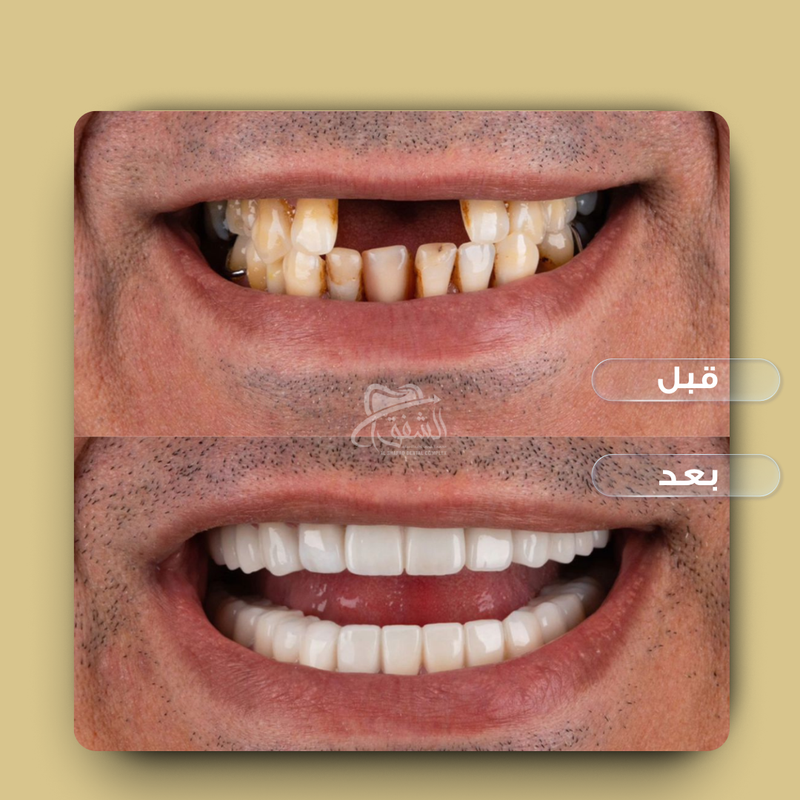 تقويم وتركيبات