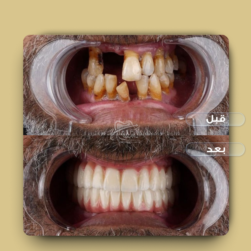 تقويم وتركيبات