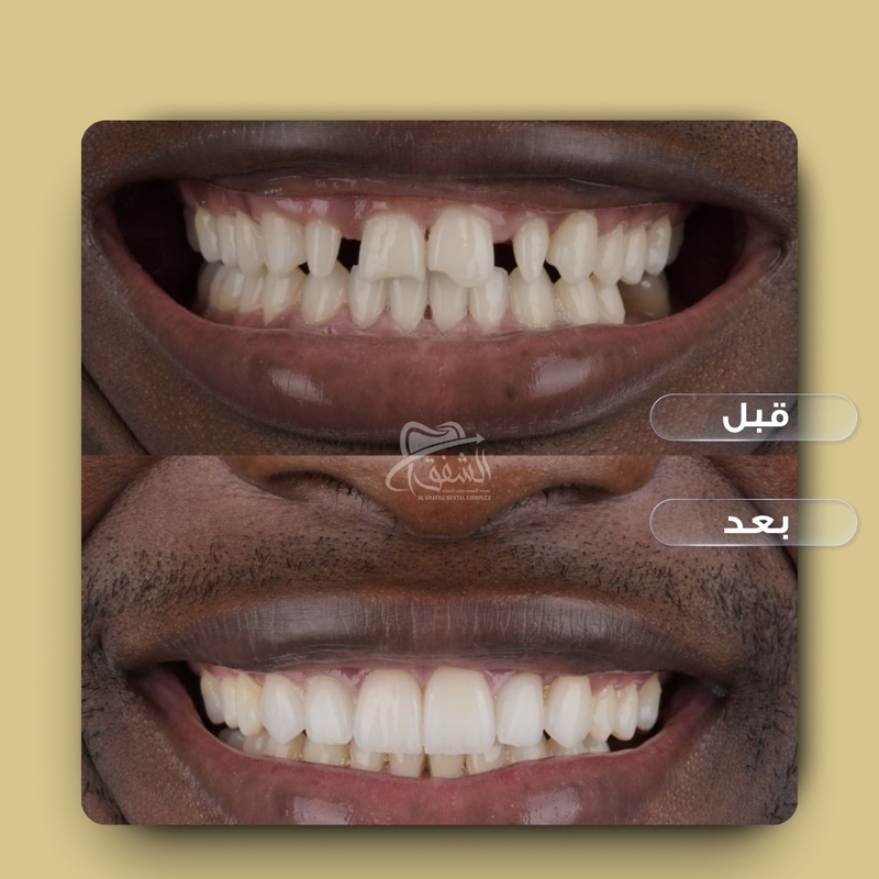 تقويم وتركيبات