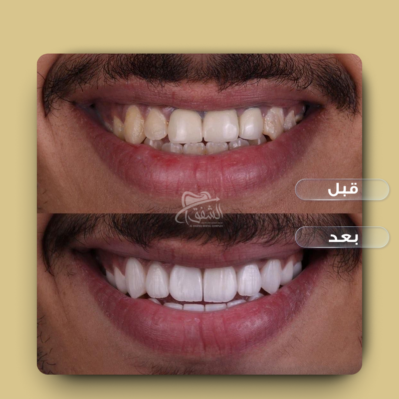 تقويم وتركيبات