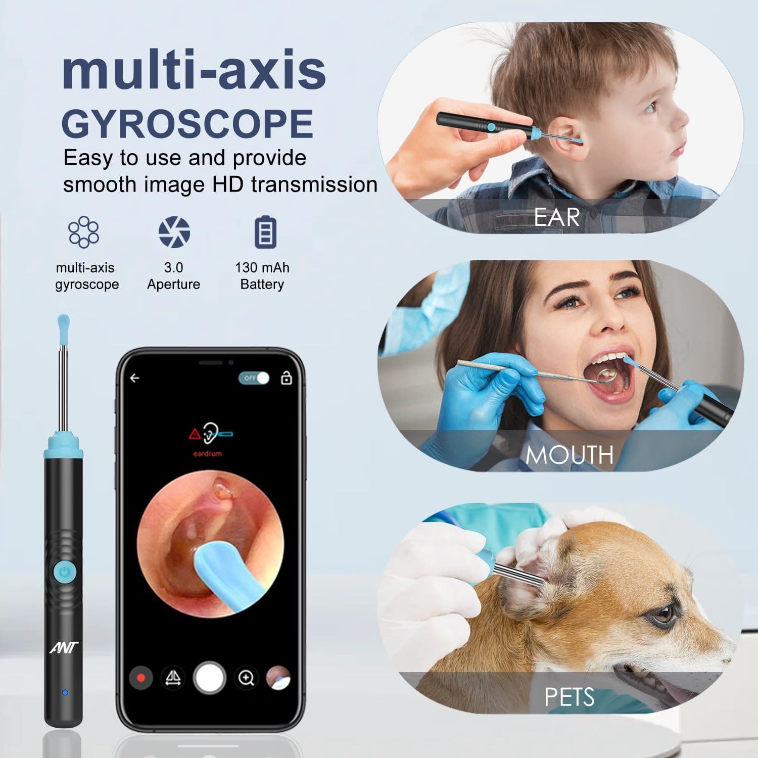 EaroPro Earwax Remover 𝐇𝐔𝐑𝐑𝐘 𝐔𝐏