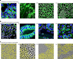 Accurate automated segmentation of autophagic bodies in yeast vacuoles using cellpose 2.0