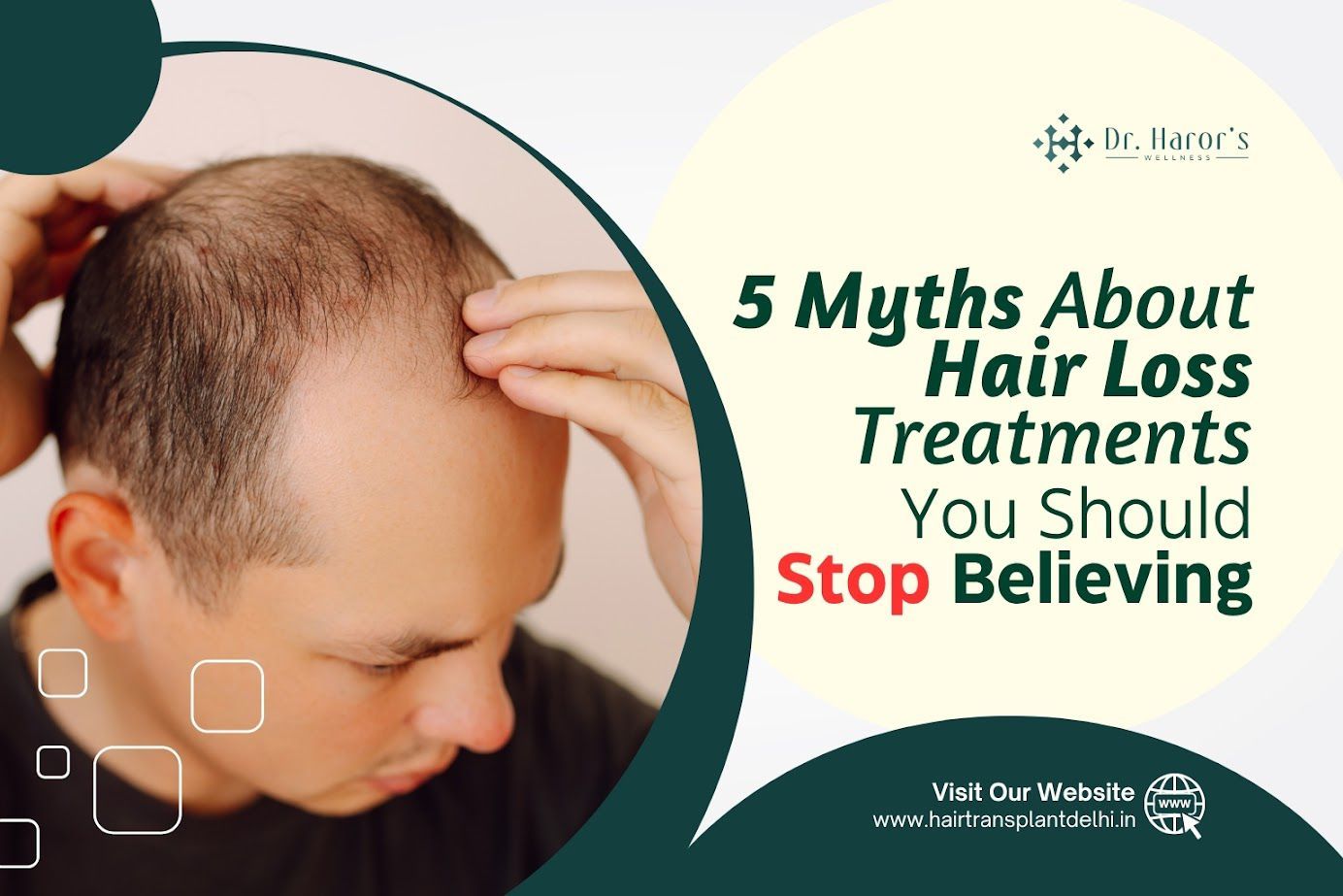 5 Hair Loss Treatment Myths That Are Holding You Back