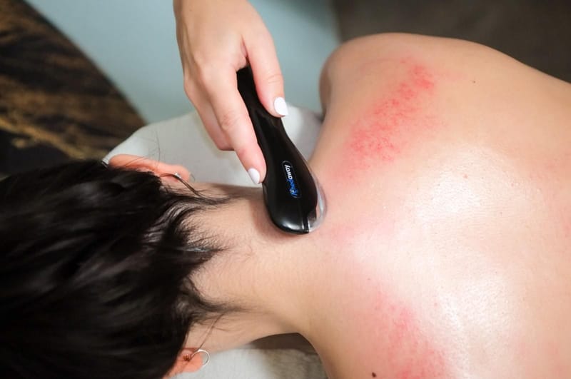 Facia therapie Helmond