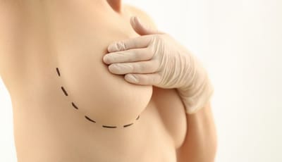 Tout savoir sur les Cicatrices...