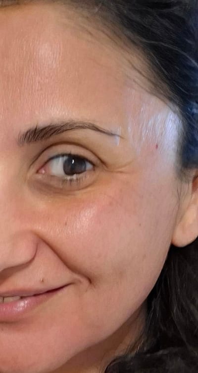 Η Αληθινή Υγεία του Δέρματος – Όλα ξεκινούν από το δερματικό μικροβίωμα