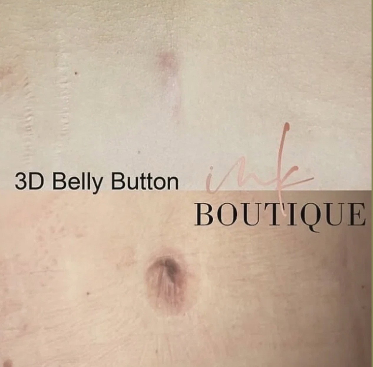 3D Belly Button - Before/After