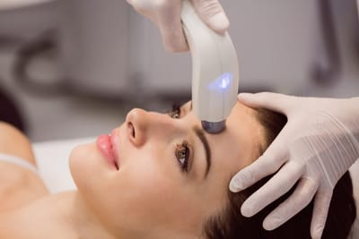 How can Pico Laser improve acne scar appearance?