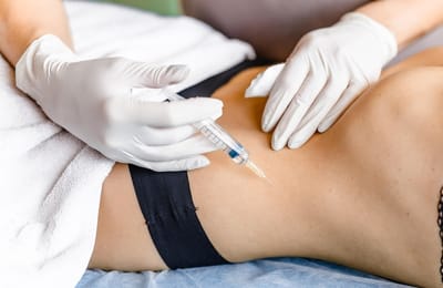 Do Fat Transfer Treatment Improve Skin Quality?