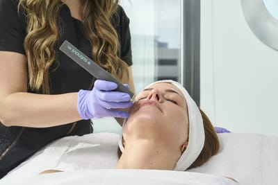 What Skin Types Are Best for Plasma Pen Use?