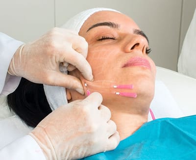 Why Do PDO Mono Threads Improve Skin Elasticity?