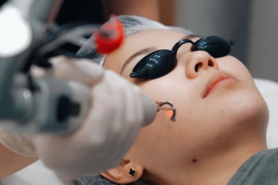 Improve Skin Clarity with Pico Laser at Dynamic Life Clinics