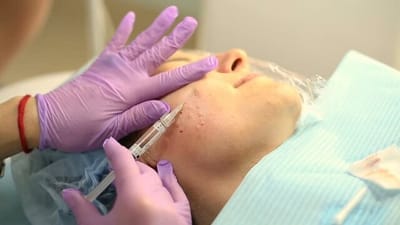 How Does a Vampire Facial Help Maintain Youthful Skin?