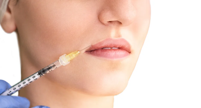 Can Belotero Fillers Help With Lip Definition?