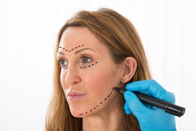 What Skin Concerns Can Endolift Treatment Address?