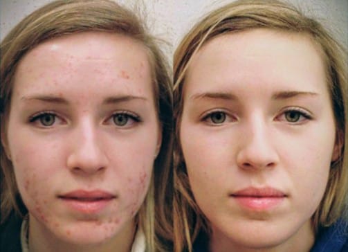 Individuální řešení problematické pleti Praha