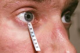 فحص جفاف العين