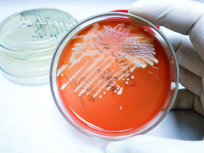 AI Microbiome Testing