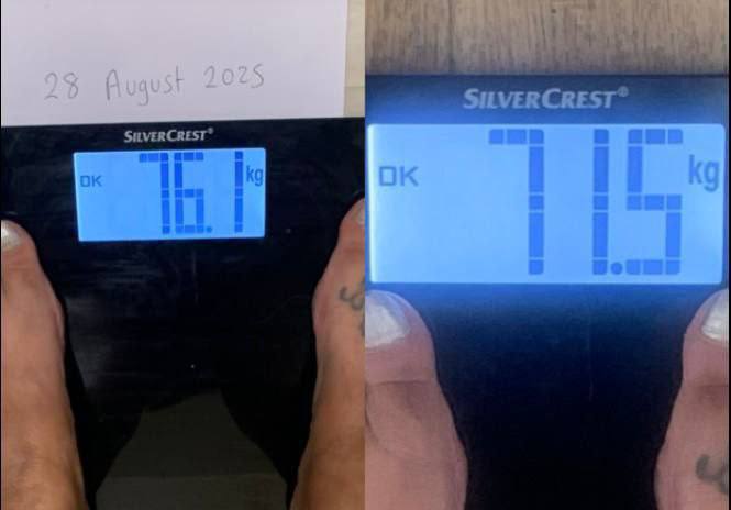 Obesity Treatment Innovation