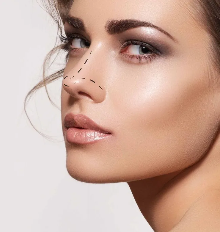 Open Rhinoplasty Recovery Timeline: What to Expect Week by Week