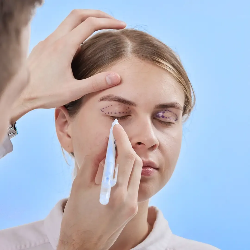 How to Qualify for Eyelid Surgery in Vietnam: A Guide for International Patients