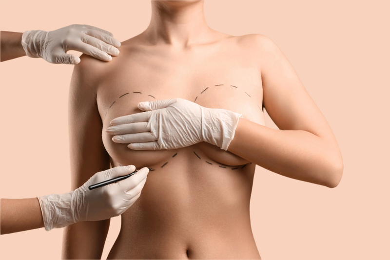 Hidden Expenses: How Much Does Breast Augmentation Cost in Vietnam Really?