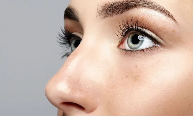 Is Closed Rhinoplasty Right for You? Everything You Need to Know
