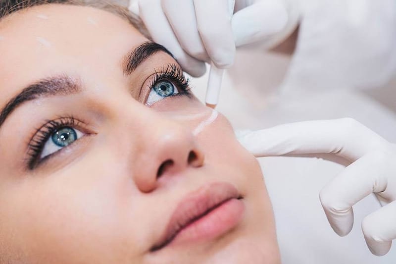 Eyelid Surgery Cost in Vietnam: Comparing Quality and Prices with Other Countries