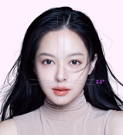 Korean Rhinoplasty Recovery: Timeline and Tips for Long-Lasting Results