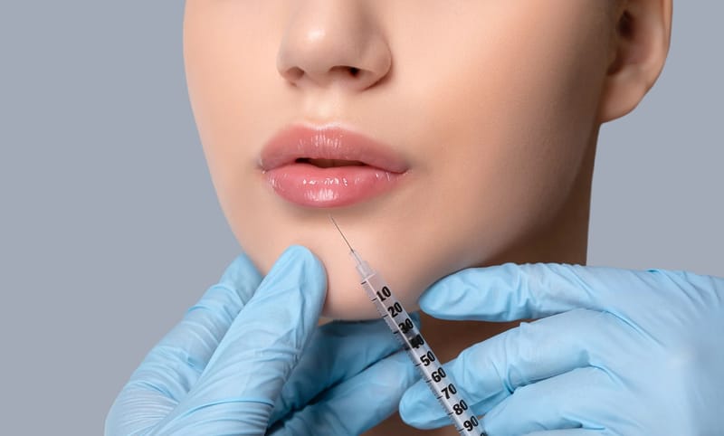 Safety and Comfort: Why Choose Micro Needle Lip Filler for Your First Time