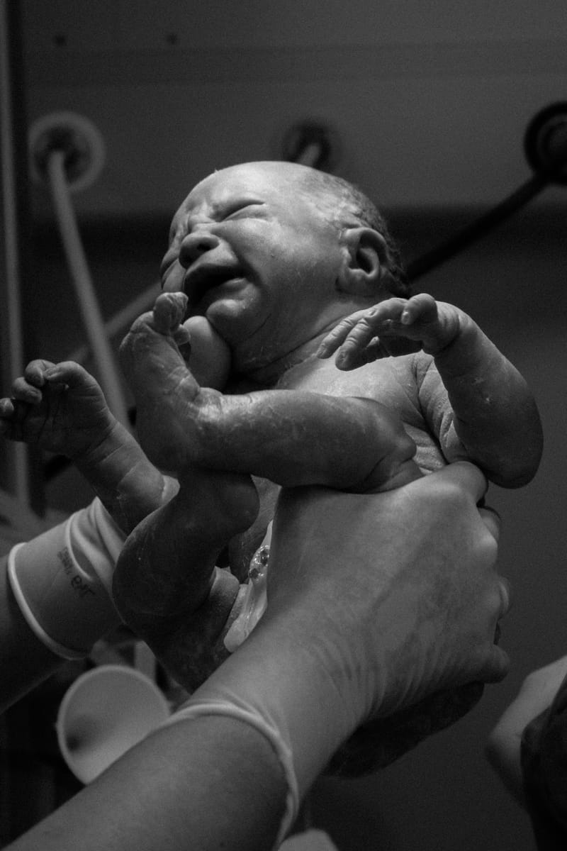 C-Section