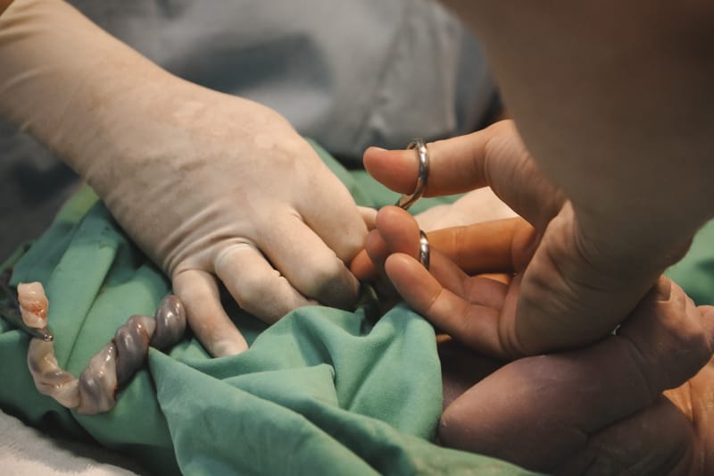 C-Section
